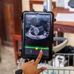 AIUltrasound1.jpg