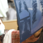 Healthcare worker looks at TB scan