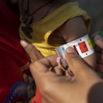 Acute malnutrition measurement 1